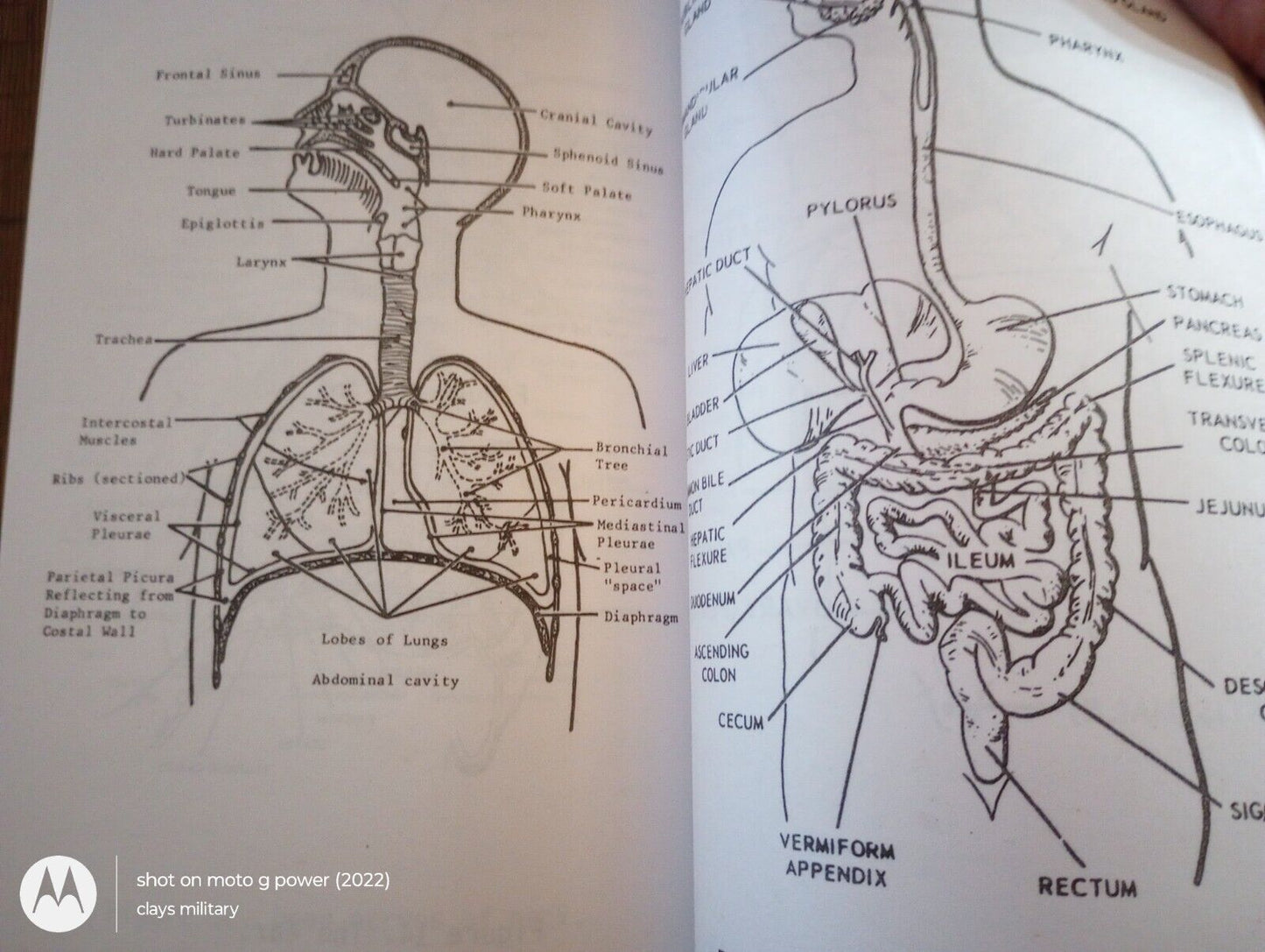 U.S ARMY SPECIAL FORCES MILITARY MEDICAL HANDBOOK TRAINING ST 31-91B